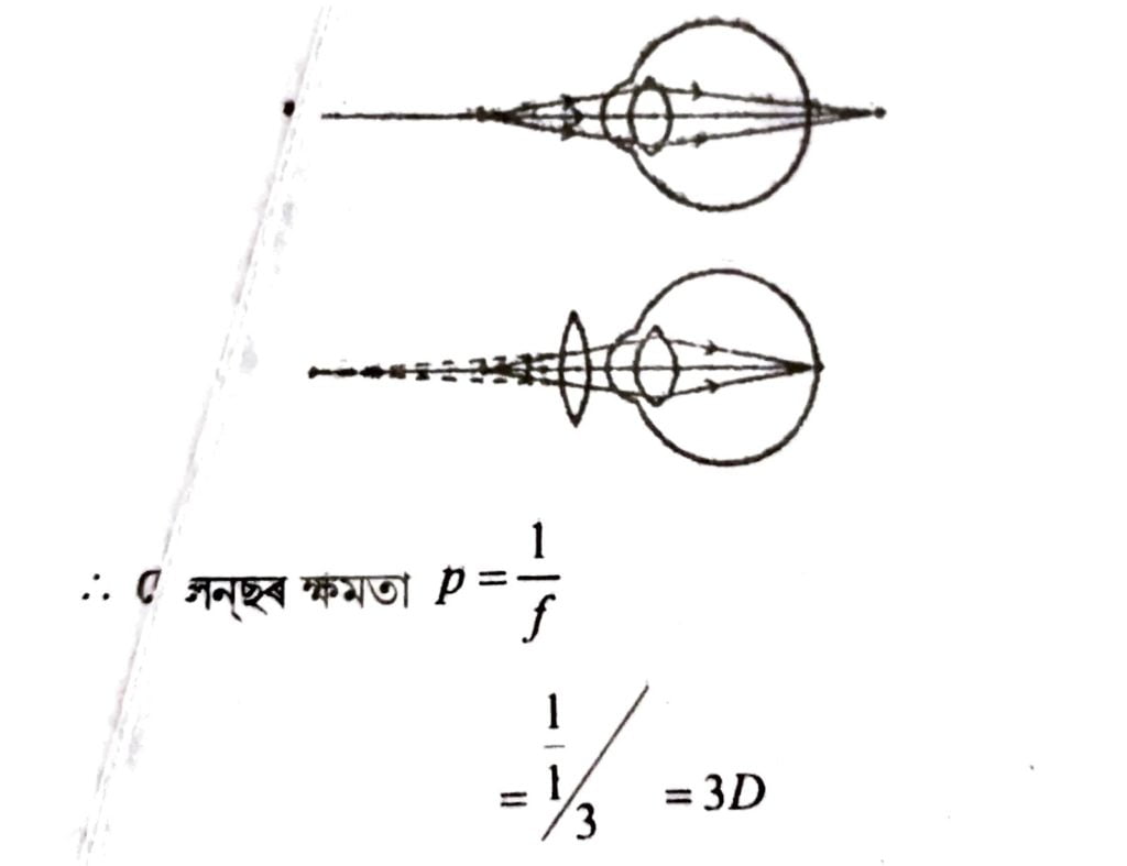 দূৰদৃষ্টিগ্ৰস্ততা ৰ সংশোধন দেখুৱাই ৰশ্মিচিত্র অংকন কৰা
