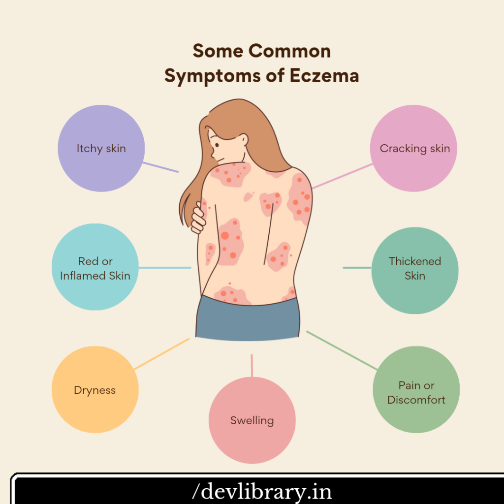 একজিমাৰ লক্ষণসমূহ