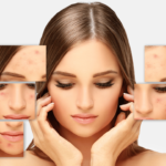 শালমইনা বা ব্রণ কি - Acne in Assamese