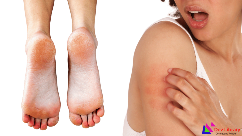 শীত কালত ছাল শুকান কিয় হয়? কাৰণ, লক্ষণ আৰু ঘৰুৱা প্ৰতিকাৰ