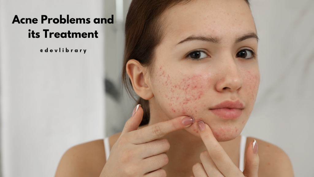 Acne Problems and its Treatment | ব্ৰণৰ সমস্যা আৰু ইয়াৰ প্ৰতিকাৰ