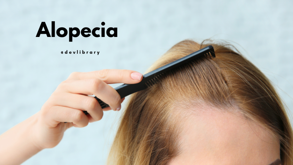 Alopecia Problem | এলʼপেচিয়াৰ সমস্যা