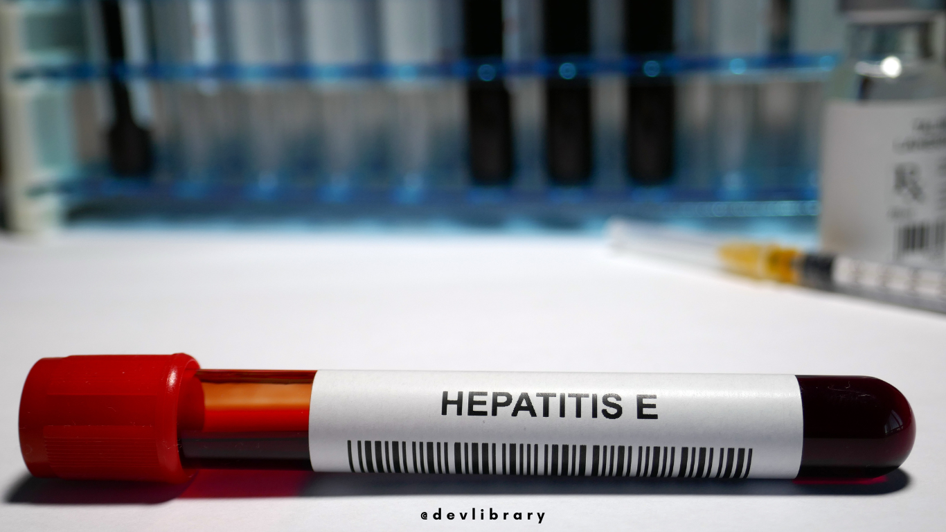 Hepatitis E Problem and Treatment | হেপাটাইটিছ E-ৰ সমস্যা আৰু প্ৰতিকাৰ 