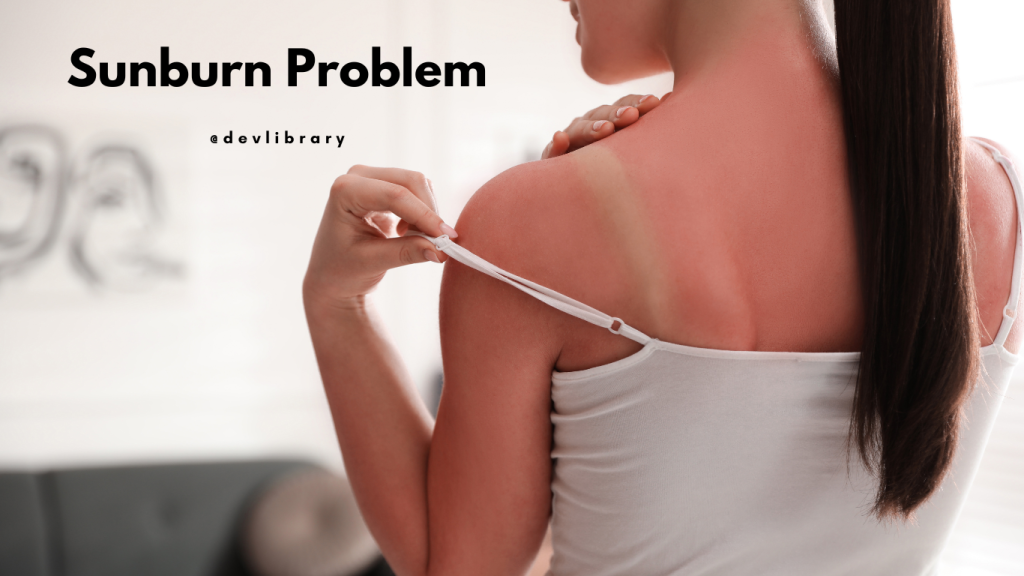Sunburn Problem | চাণবাৰ্ণৰ সমস্যা