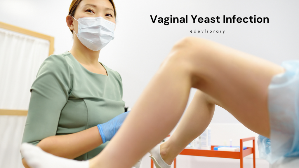 Vaginal Yeast Infection and Treatment | যোনিৰ ইষ্ট সংক্ৰমণৰ সমস্যা আৰু প্ৰতিকাৰ 