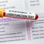 LFT Test