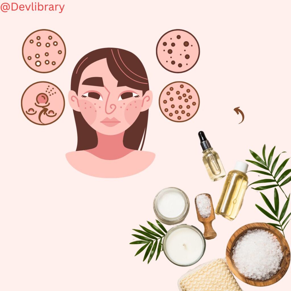 Acne Treatment Causes, Symptoms, Types, and Effective Remedies