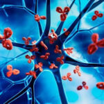 Treatment of Autoimmune Diseases